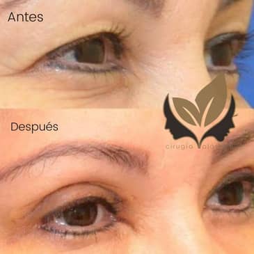 Slider image (6) Dr. Israel Villalobos